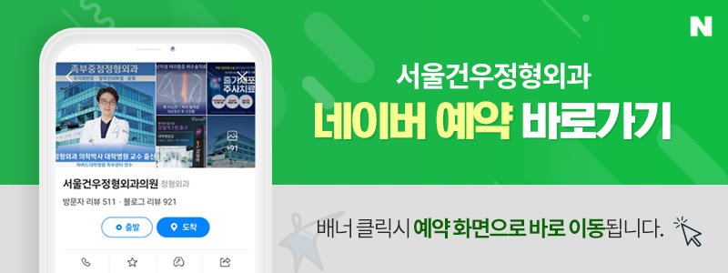 서울 무지외반증 교정수술